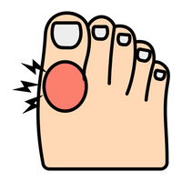 Overall foot relief